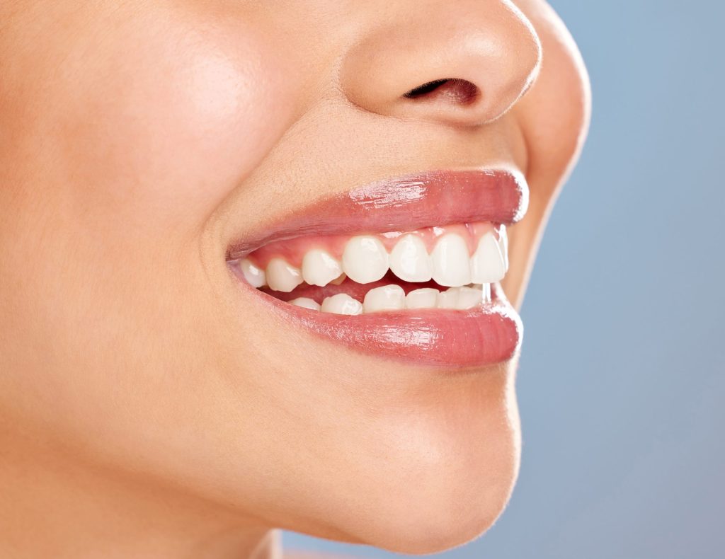 Bone Grafting for Dental Implants: A Confident Smile
