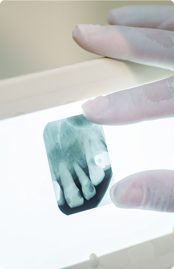 Gloved hands hold a dental X-ray film against a lightbox, showing a close-up view of teeth. The setting is clinical and professional.