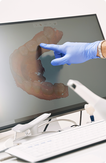 Gloved hand pointing at a 3D dental scan on a computer screen in a dental office, conveying a modern, clinical, and professional atmosphere.